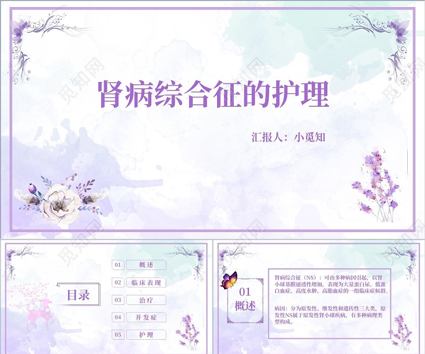 紫色清新风 肾病综合征PPT模板肾病综合征护理查房 紫色清新风 肾病综合征PPT模板肾病综合征护理查房